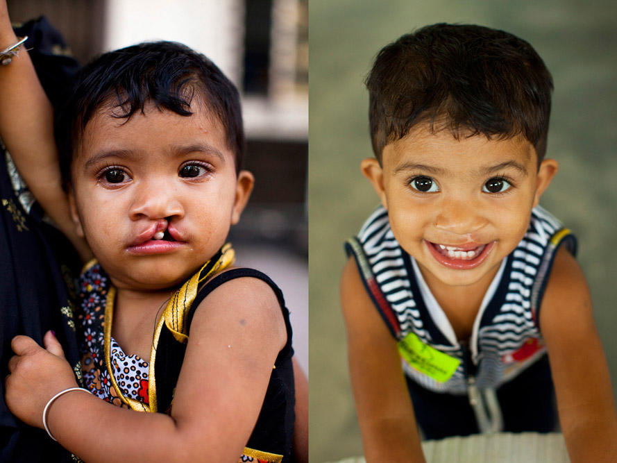 100 Smiles in 100 Days