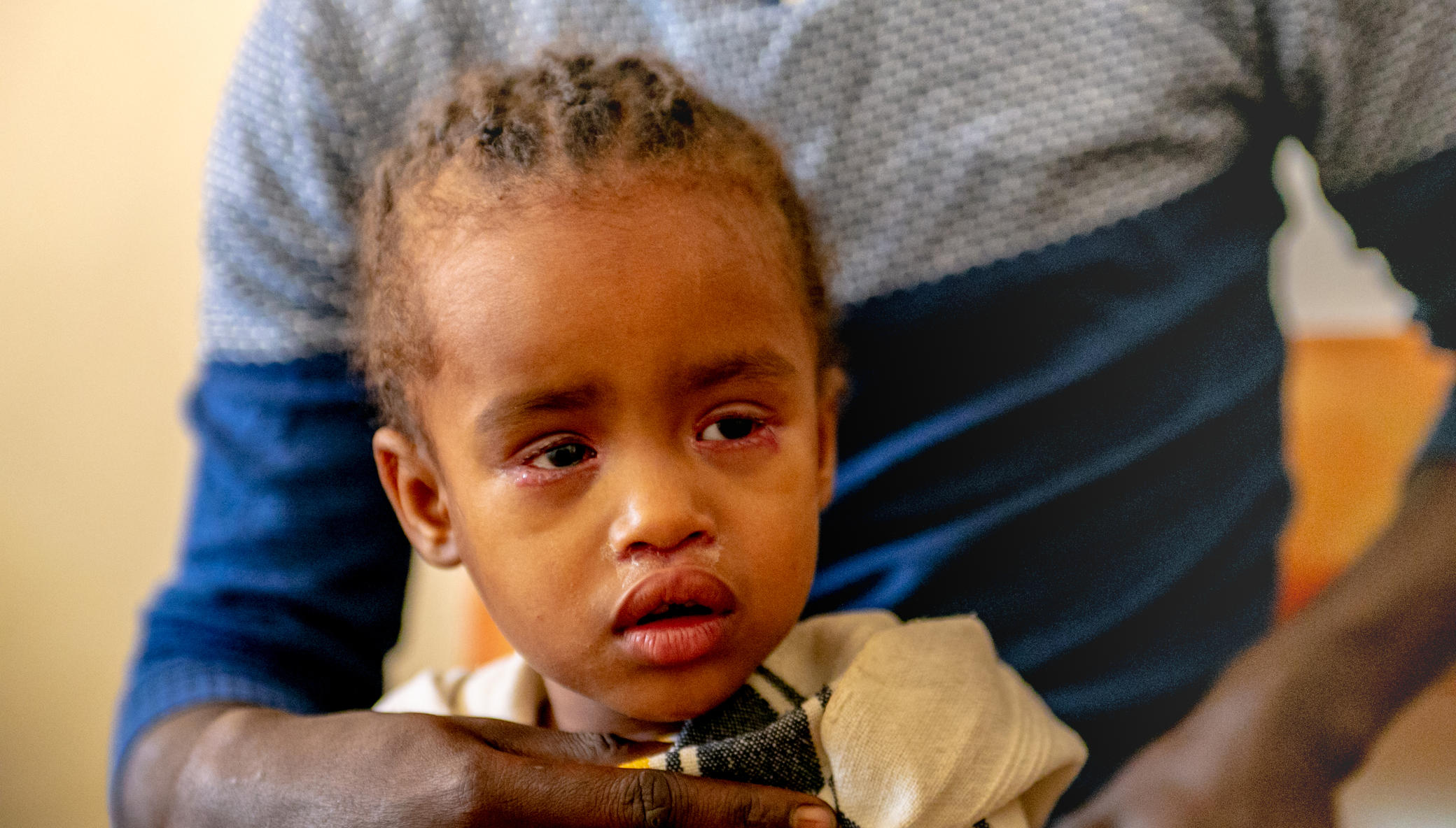 Distributing Medication to Prevent Blindness