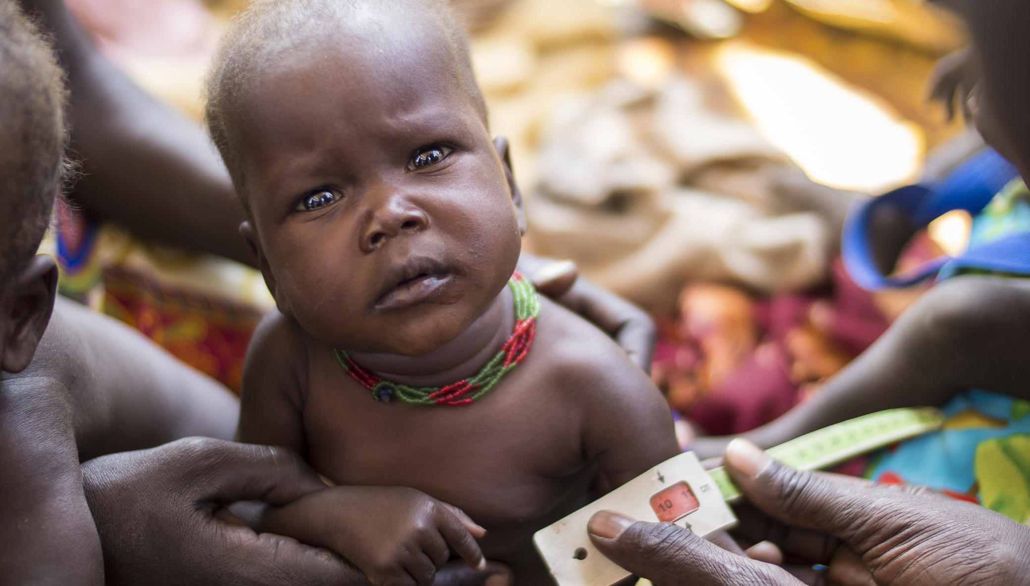 East Africa Hunger Crisis: Concern's Response