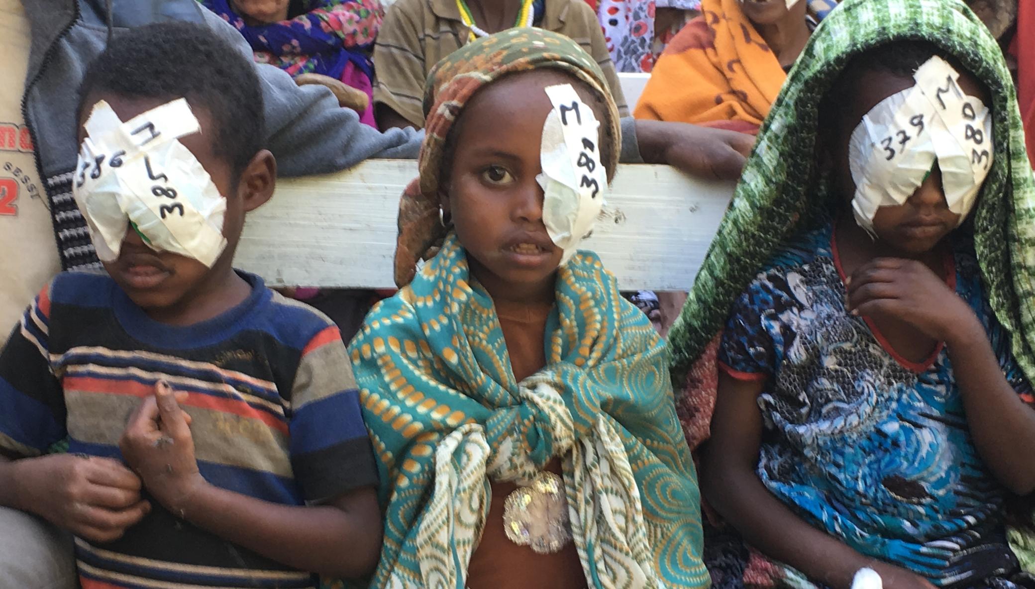 Outreach Eye Camps in Ethiopia